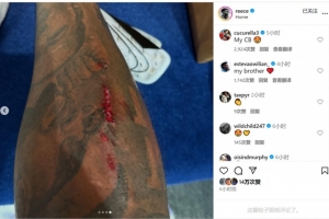 踢滿全場(chǎng)+客串中衛(wèi)！里斯-詹姆斯社媒曬腿上傷口